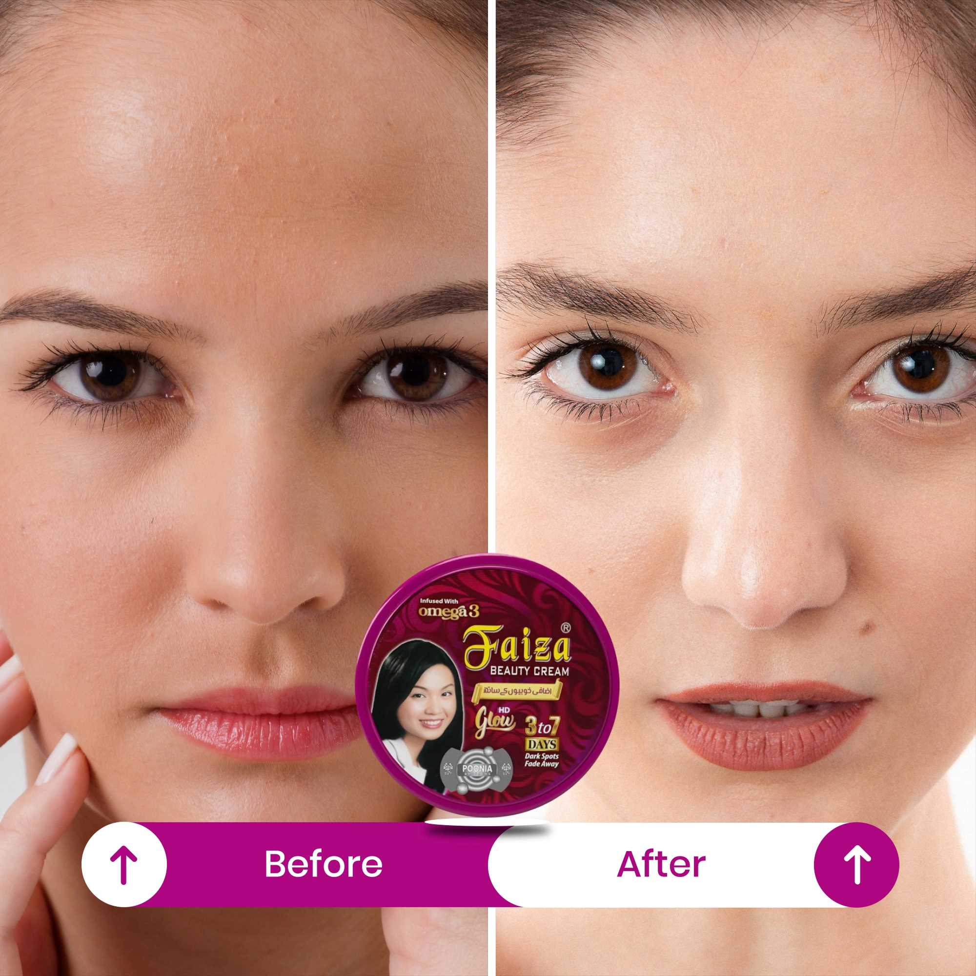 Before and After transformation using Faiza Beauty Cream with Omega 3 showing dark spots fade away in 7 days.