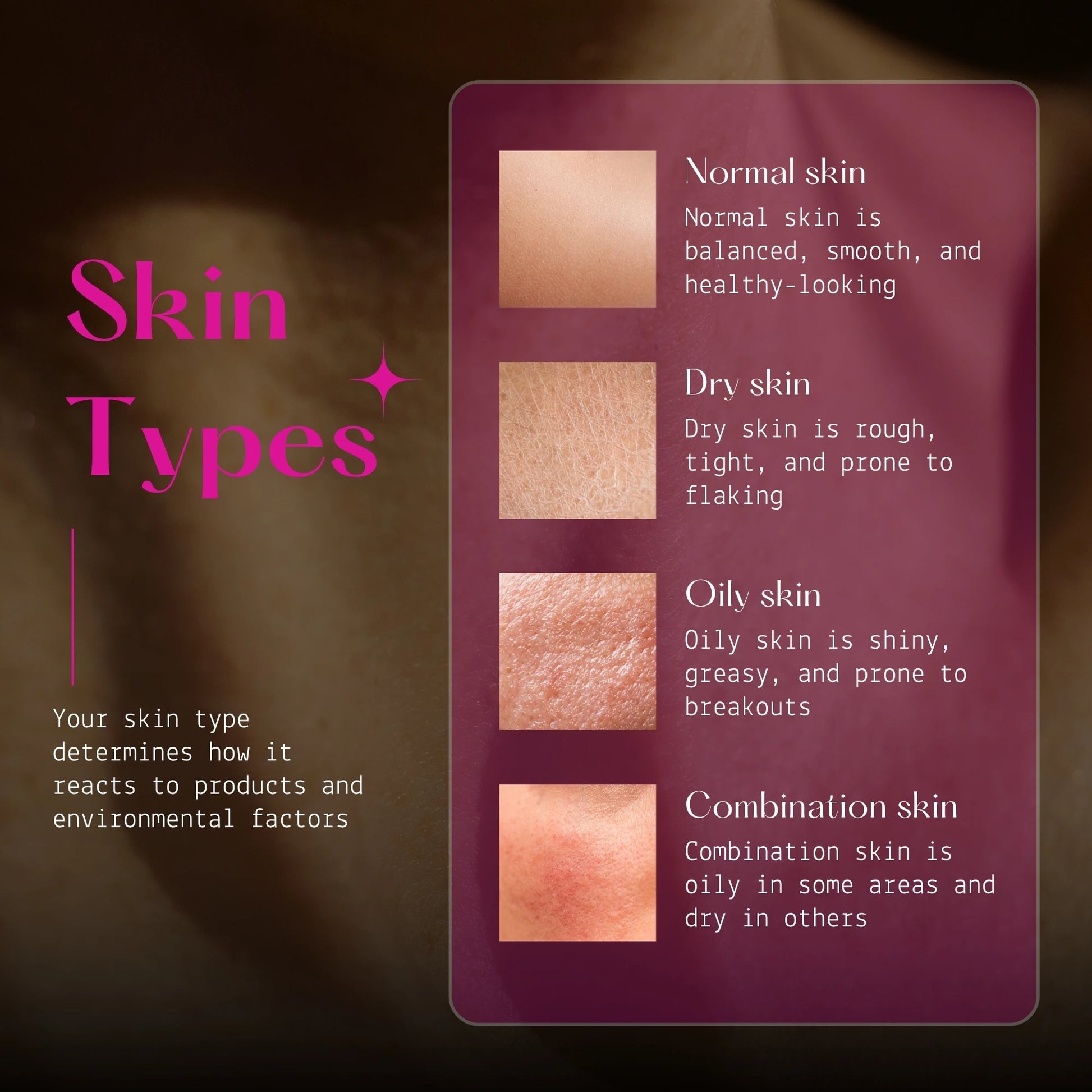 Graphic explaining the characteristics of Normal, Dry, Oily, and Combination skin types.