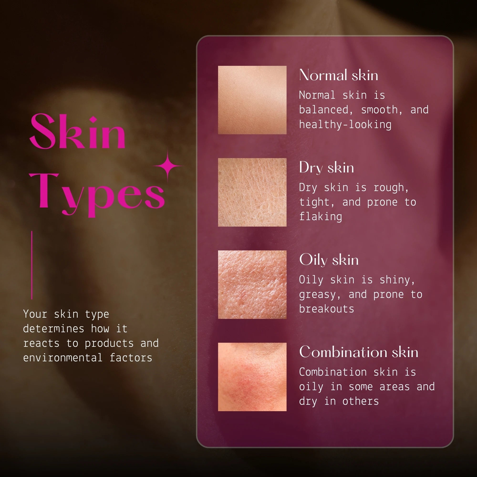 Graphic explaining the characteristics of Normal, Dry, Oily, and Combination skin types.