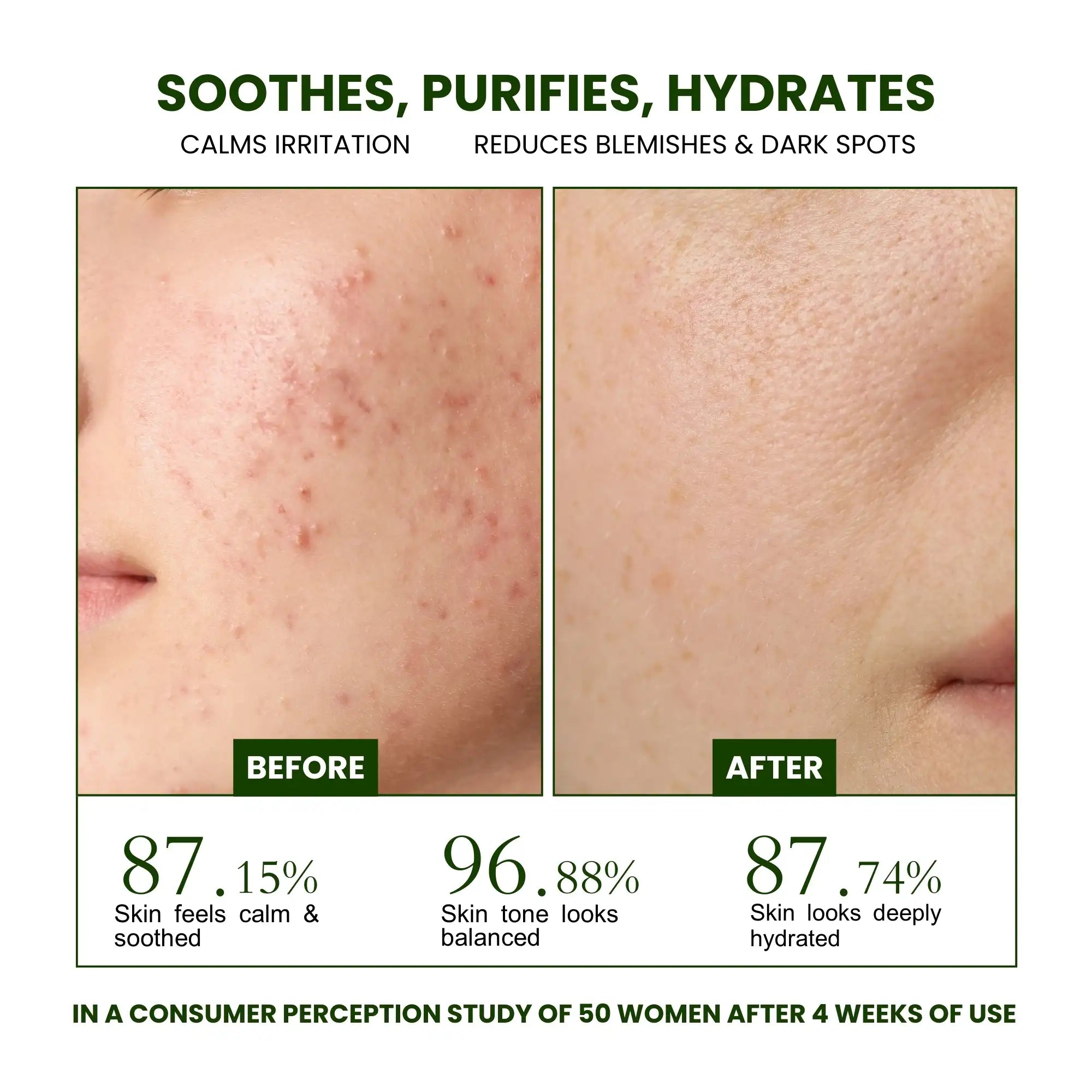 Faiza Cosmetics Gentle Hydration Hero, non-greasy hydration, calms irritated skin, prevents breakouts, removes dirt and impurities, sensitive skin cleanser