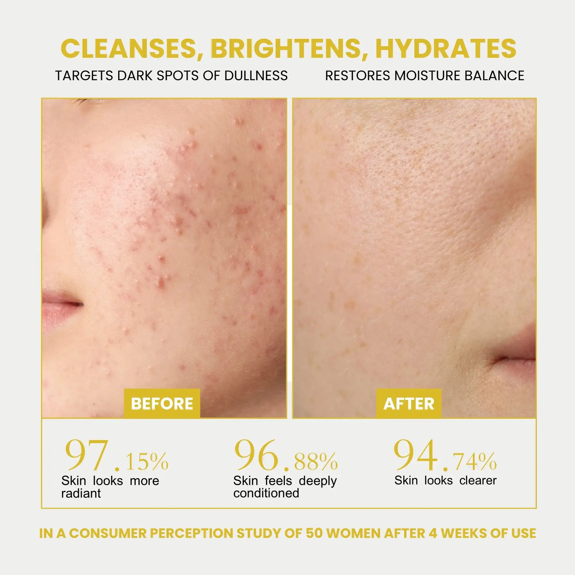 Faiza Cosmetics Cleanser, Before After results, radiant clear skin, dark spots dullness corrector, moisturize balance, deep conditioned skin, anti-acne