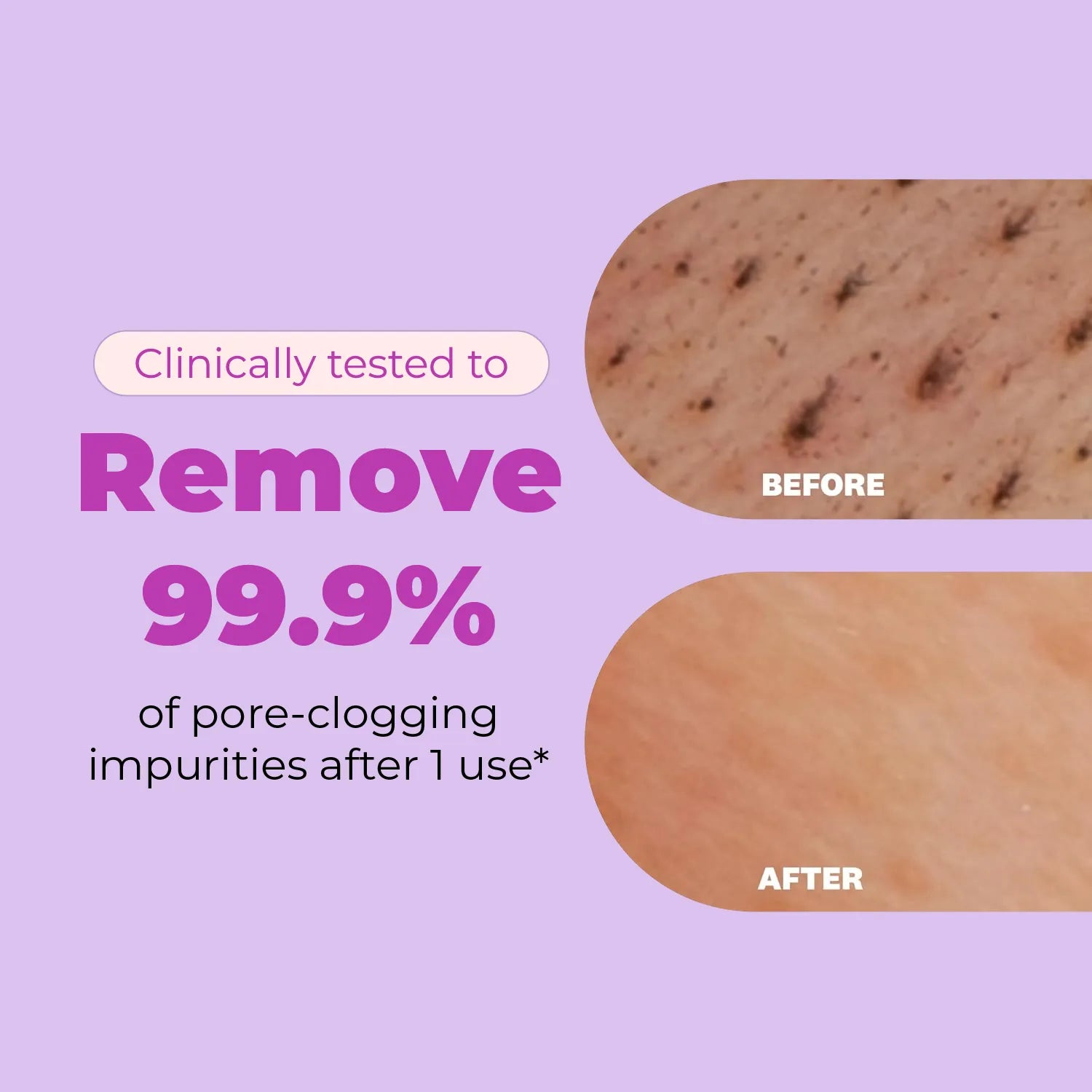 Before & After macro shots showing face wash clinically tested to remove 99.9% of pore-clogging impurities after 1 use.
